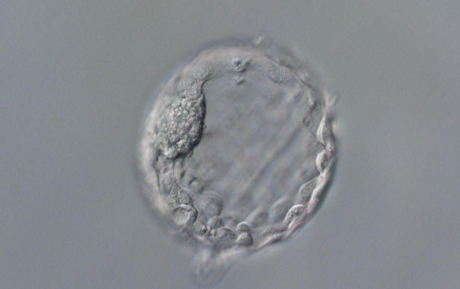 Lidské embryo ve stadiu blastocysty, v jehož DNA provedla skupina Dietera Egliho editaci bází v genech PCSK9 a HBG. Zdroj: Štěpán Jeřábek (Columbia University a ÚOCHB AV ČR) UOCHB embryo