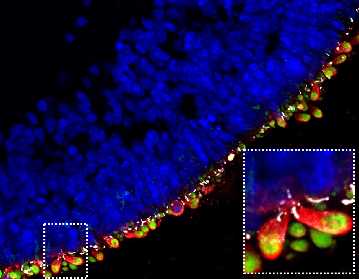 retinalniorganoidy 04