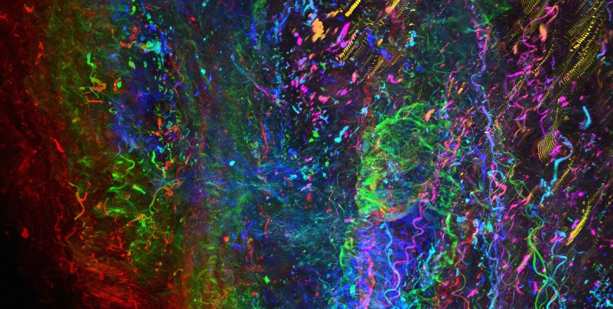 SoraiaFernandes 2matrix