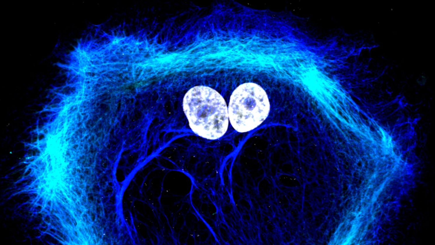 SoraiaFernandes prostata