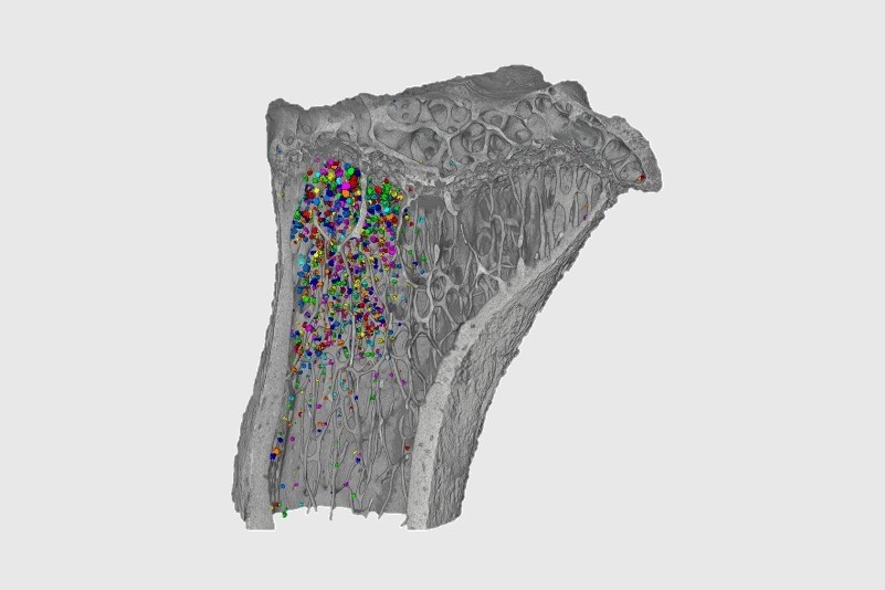 Zobrazení tukových buněk – adipocytů – ve struktuře kosti. Barevně označené kuličky reprezentují jednotlivé tukové buňky.