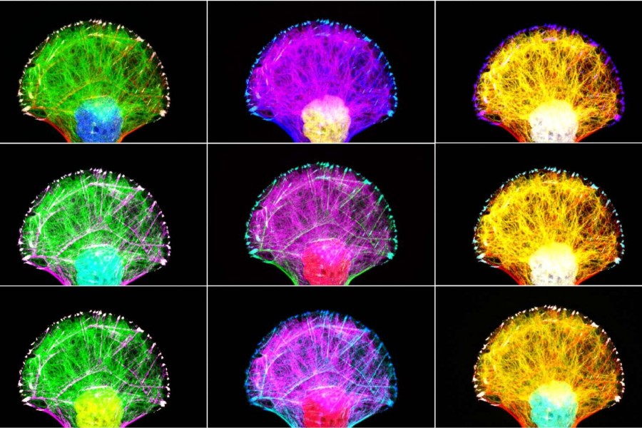 Lidská rakovinná buňka hepatocelulárního karcinomu s imunofluorescenčně značenými složkami cytoskeletu a buněčných spojů./ Foto: Ústav molekulární genetiky AV ČR