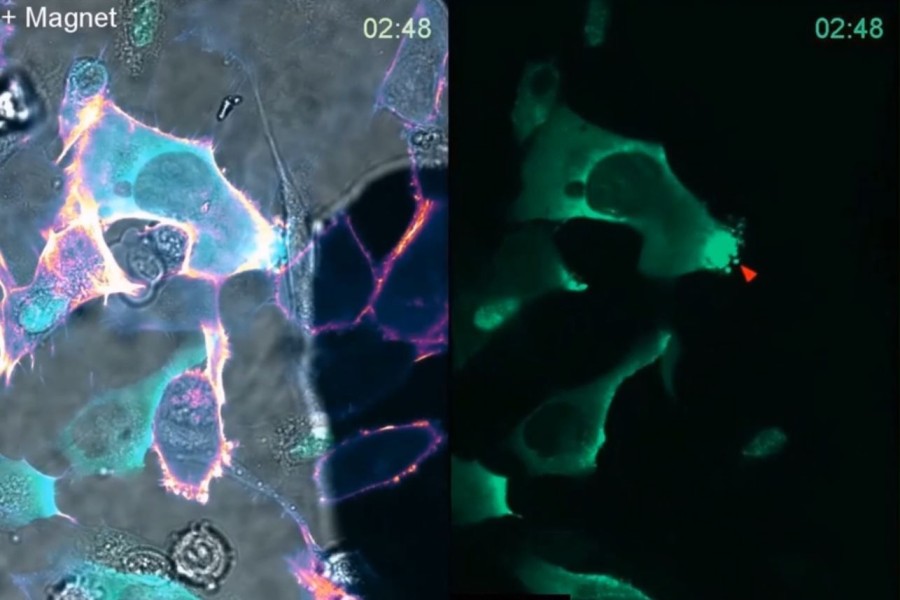 Ukázka magnetické manipulace magnetických nanočástic (zeleně) v živých nádorových buňkách včetně několika ukázek magnetické manipulace Rab25 pozitivních váčků | Foto: Jakub Gemperle z ÚMG AV ČR