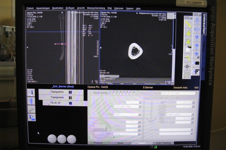 Detail skenování holenní kosti | Foto: Archiv Vladimíra Sládka